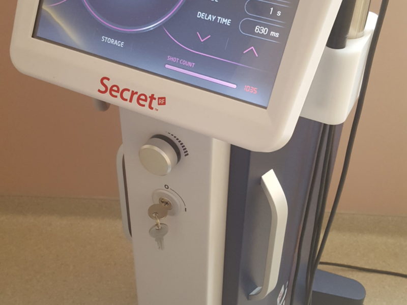 Ilooda Secret