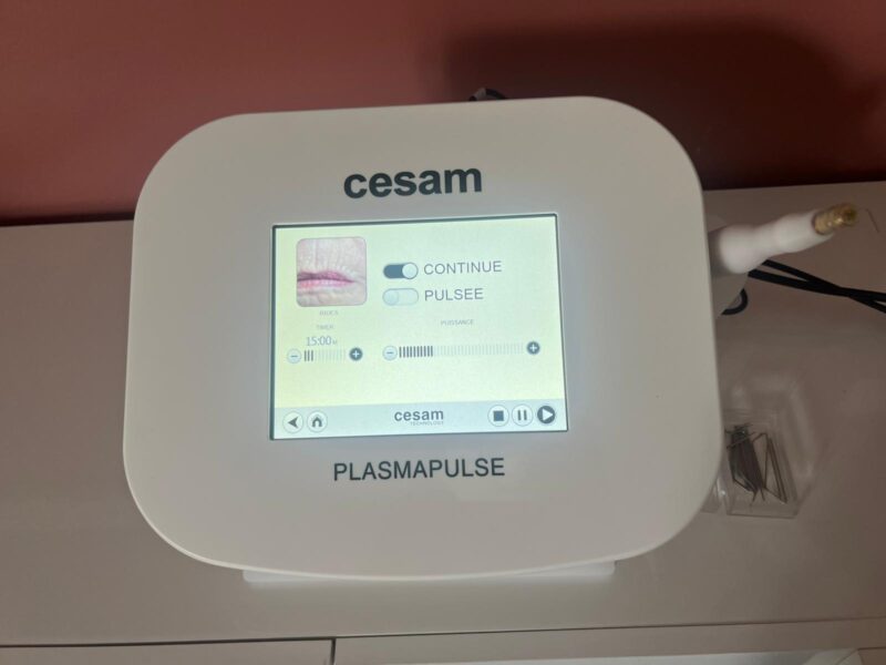 Plasma Pulse