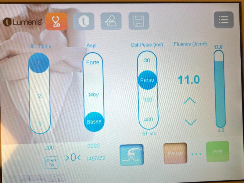 Lumenis LightSheer Desire